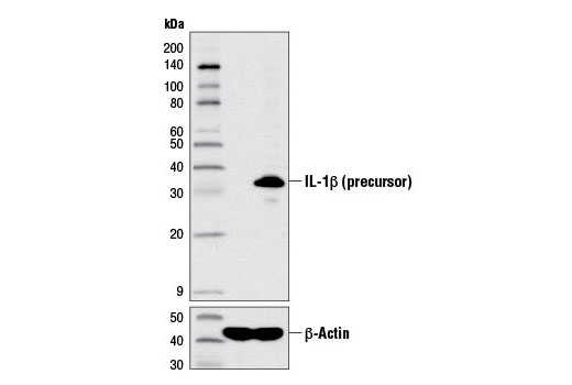 IL-1β (D3U3E) Rabbit mAb #12703