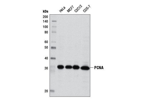 PCNA (D3H8P) XP® Rabbit mAb  #13110