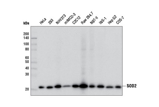 SOD2 (D3X8F) XP® Rabbit mAb #13141