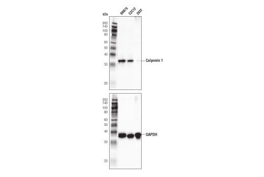 Calponin 1 (D8L2T) XP® Rabbit mAb #17819