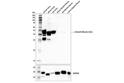 α-Smooth Muscle Actin (D4K9N) XP® Rabbit mAb #19245