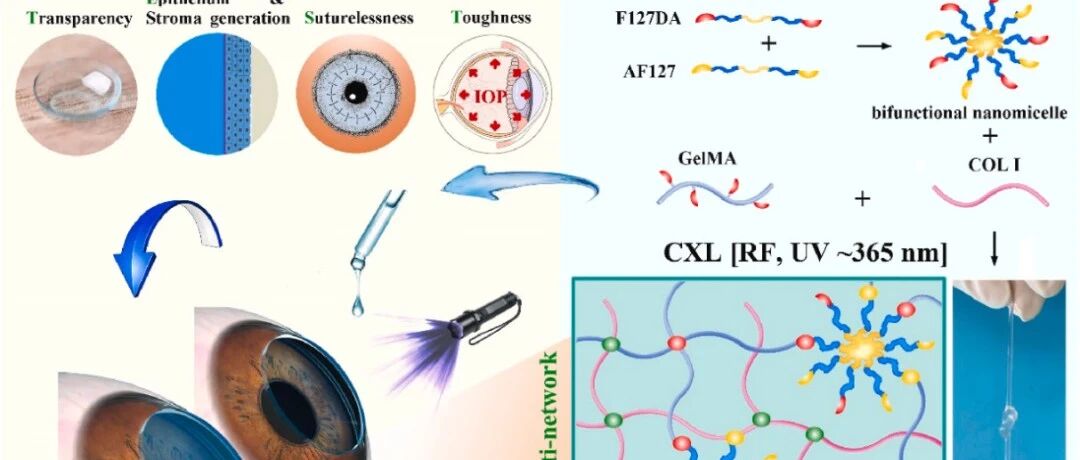《Bioactive Materials》：如何利用光固化水凝胶实现角膜无缝修复？