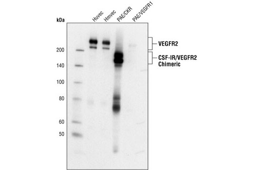 VEGF Receptor 2 (55B11) Rabbit mAb #2479