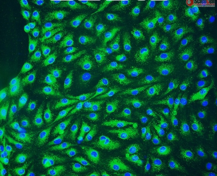 Human Lymphatic Endothelial Cells