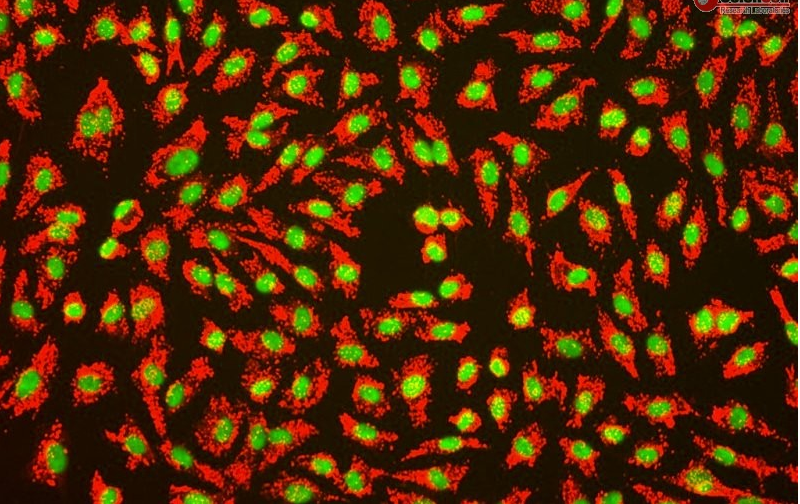 Human Umbilical Vein Endothelial Cells
