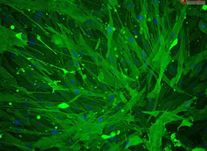 Human Umbilical Artery Smooth Muscle Cells