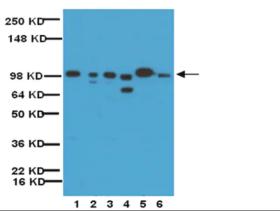 Anti-MMP-9 Antibody, Catalytic domain AB19016