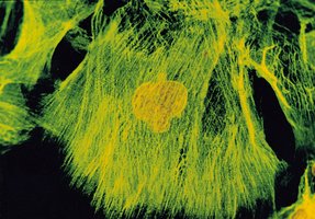 两性霉素 B 溶液