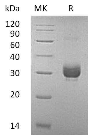 Recombinant Mouse Noggin (C-6His)(Cat. No.:C028)