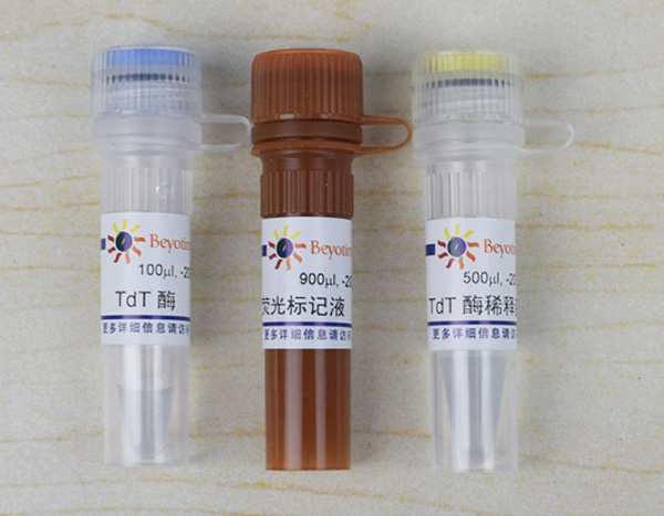 一步法TUNEL细胞凋亡检测试剂盒(绿色荧光)