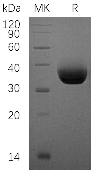 Recombinant Human PD-L1 (C-6His)(Cat. No.:C315)