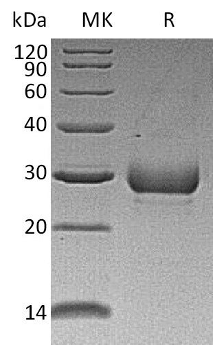 Recombinant Human Noggin(Cat. No.:CB89)