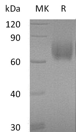 Recombinant Human B7-H3 (C-6His)(Cat. No.:CK62)