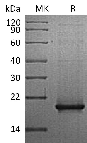 Recombinant Human RANK L(Cat. No.:CK63)