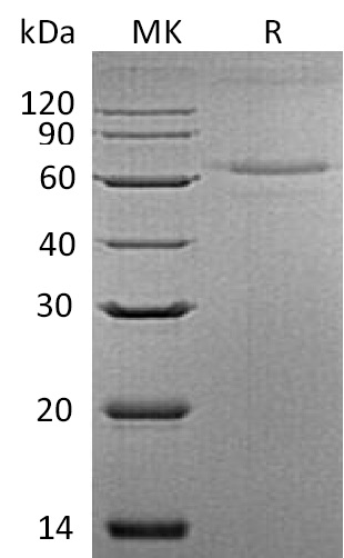 Recombinant Mouse IL-27 (C-6His)(Cat. No.:CS44)