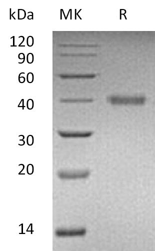 Recombinant Human RSPO1 (C-6His)(Cat. No.:CX83)