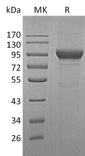Recombinant Human MPO(Cat. No.:DCS73)