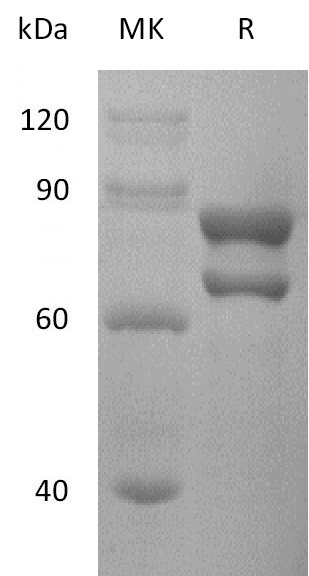 Recombinant ASFV p72&pB602L complex(Cat. No.:DRA162)