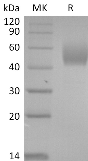 Recombinant SARS-CoV-2 S Protein NTD (C-6His)(Cat. No.:DRA45)