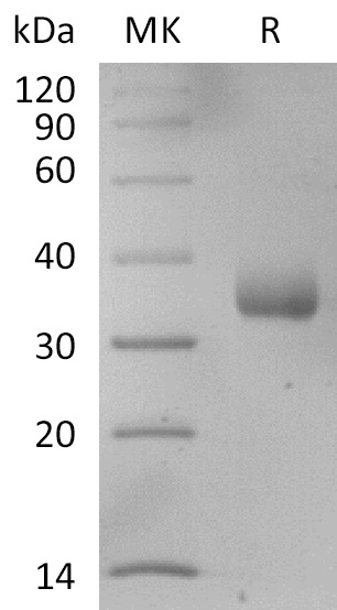 Recombinant SARS-CoV-2 S Protein RBD (C-6His) V2(Cat. No.:DRA72)