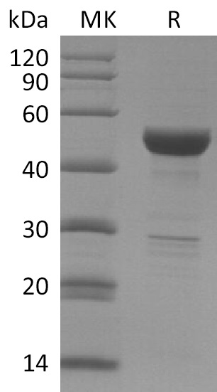 Recombinant SARS-CoV-2 Nucleocapsid Protein (Mammalian, C-6His)(Cat. No.:DRA91)