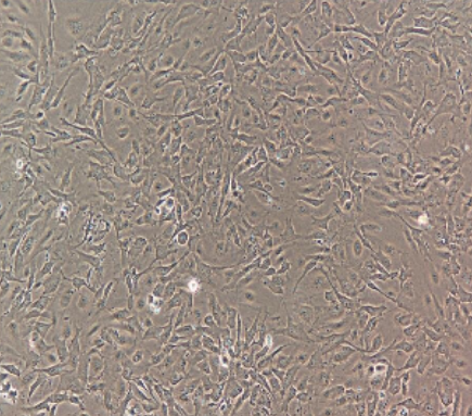 肝窦内皮细胞 HUM-iCell-d018