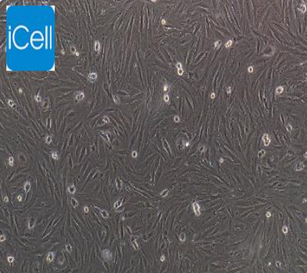 人子宫内膜间质细胞 HUM-iCell-f010