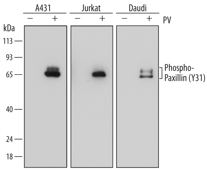 Human Phospho-Paxillin (Y31) Antibody