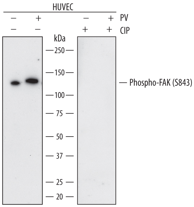 Human Phospho-FAK (S843) Antibody