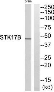 TA312139 DRAK2 (STK17B) Rabbit Polyclonal Antibody