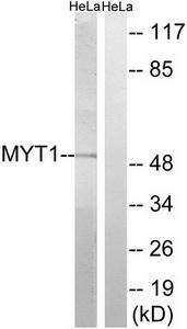TA312141  PKMYT1 Rabbit Polyclonal Antibody