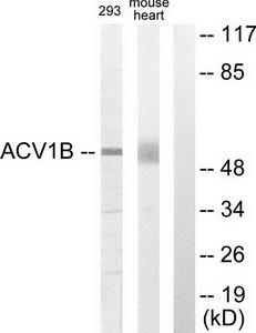 TA312143 Activin A Receptor Type IB (ACVR1B) Rabbit Polyclonal Antibody