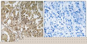 TA312145 BUB1 Rabbit Polyclonal Antibody