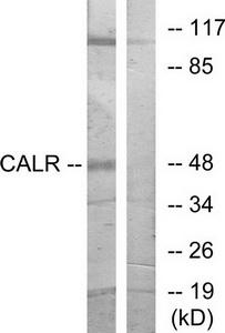 TA312147 Calreticulin (CALR) Rabbit Polyclonal Antibody