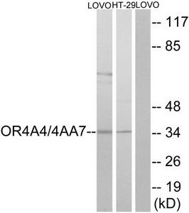 TA312150 OR4A47 Rabbit Polyclonal Antibody