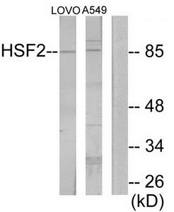 TA312156 HSF2 Rabbit Polyclonal Antibody