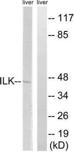 TA312157 Integrin Linked Kinase (ILK) Rabbit Polyclonal Antibody