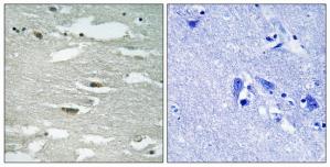 TA312158 Integrin Linked Kinase (ILK) Rabbit Polyclonal Antibody