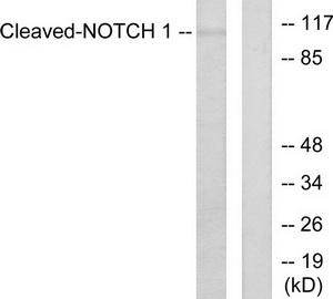 TA312382 NOTCH1 Rabbit Polyclonal Antibody