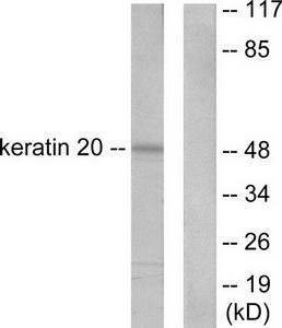 TA312388 Cytokeratin 20 (KRT20) Rabbit Polyclonal Antibody