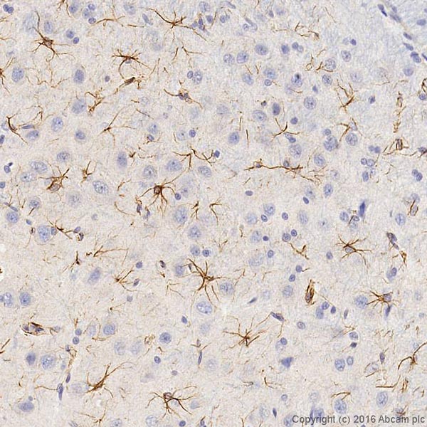 Anti-GFAP antibody [GF5] (ab10062)