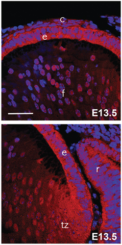 Anti-FGFR2 antibody (ab10648)