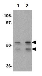 Anti-KLF4 antibody (ab106629)