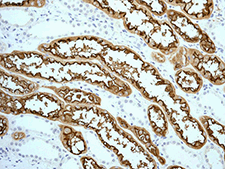 Anti-Angiotensin Converting Enzyme 2 antibody [EPR4435(2)] (ab108252)