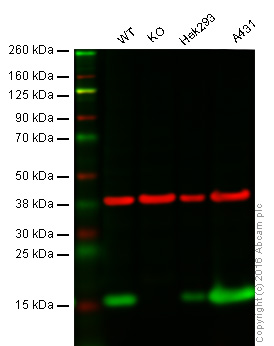 Anti-PBR antibody [EPR5384] (ab109497)