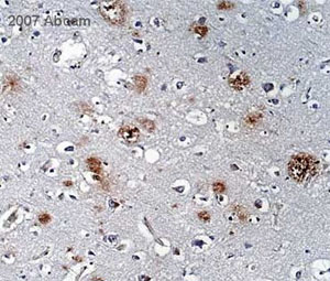 Anti-beta Amyloid antibody [DE2B4] (ab11132)