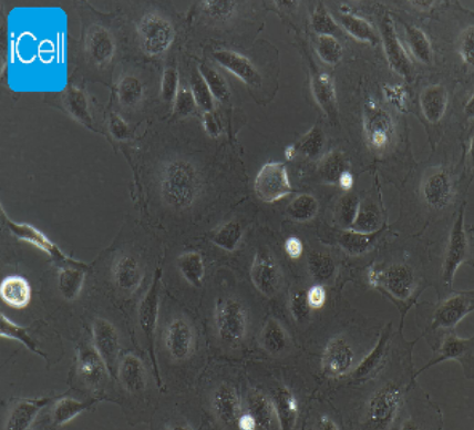 HUVEC 人脐静脉内皮细胞永生化 iCell-h110