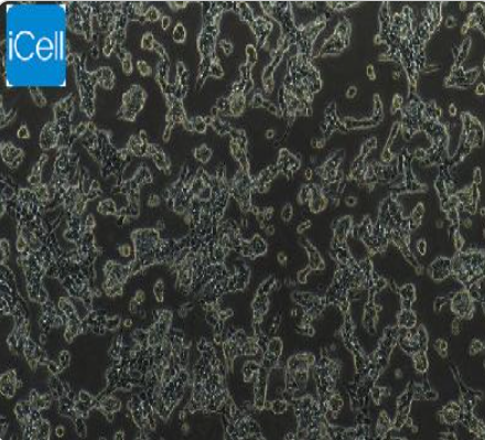 RL95-2 人子宫内膜癌细胞 iCell-h182